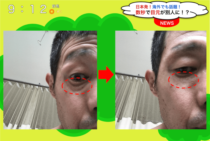 アイウルル 07385737 988f 439b ae9d aae8eb912dbc - アイウルル