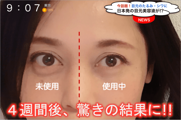 アイウルル 25d9986b 72ca 4696 8cfe 66af06049b2e - アイウルル