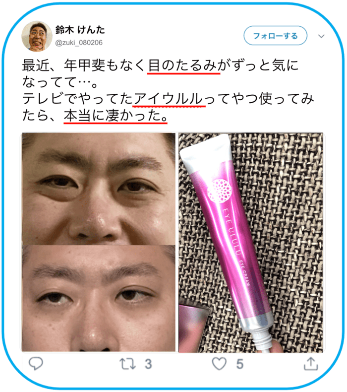 アイウルル b1291727 bdd9 4201 9540 16184e5f72e4 - アイウルル